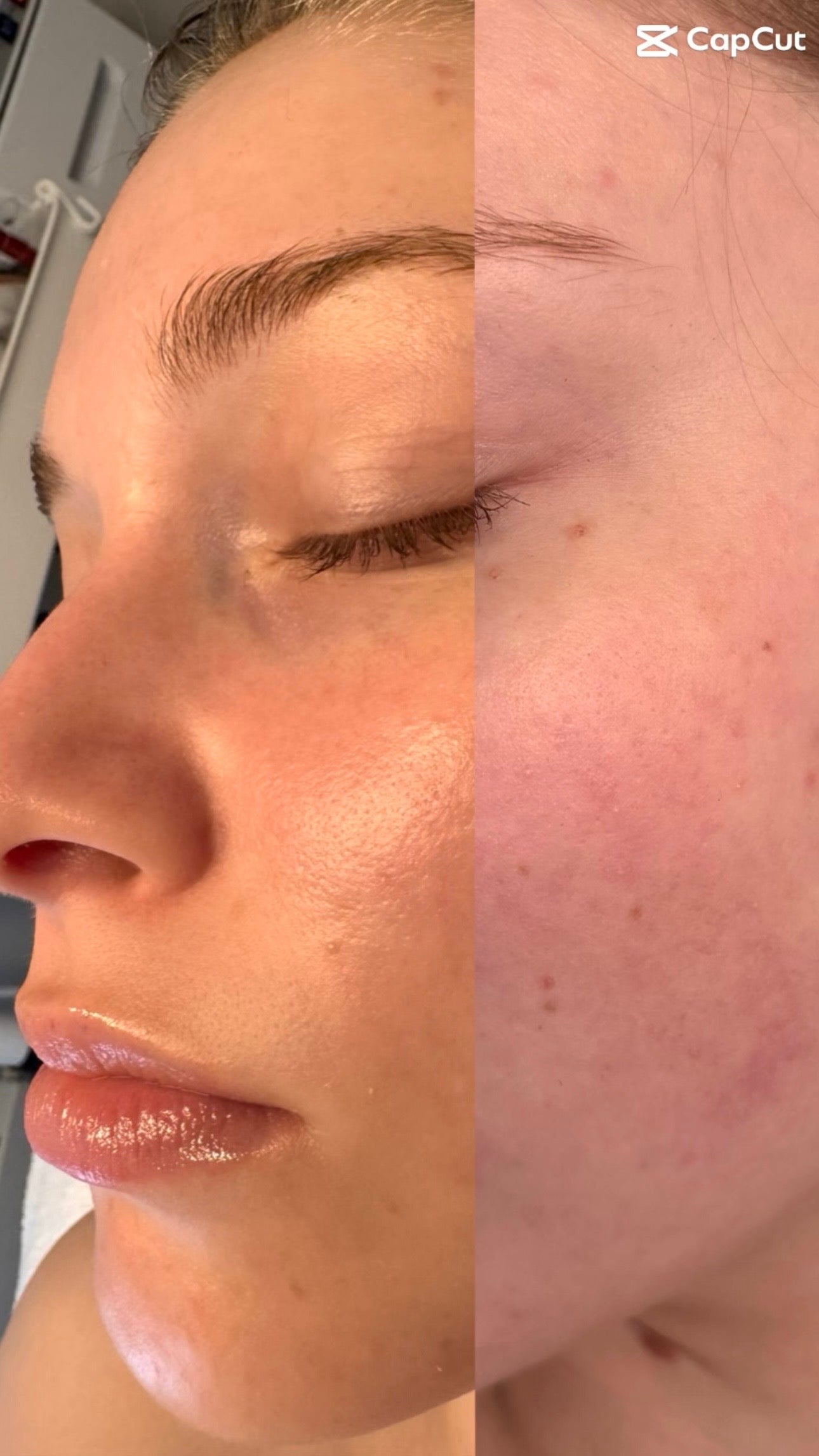 Facial comparison showing glow and vitality difference from before to after using Botanical Blueprint Sculpt Facial at Eleanor Olsen Facial Clinic, Grayshott