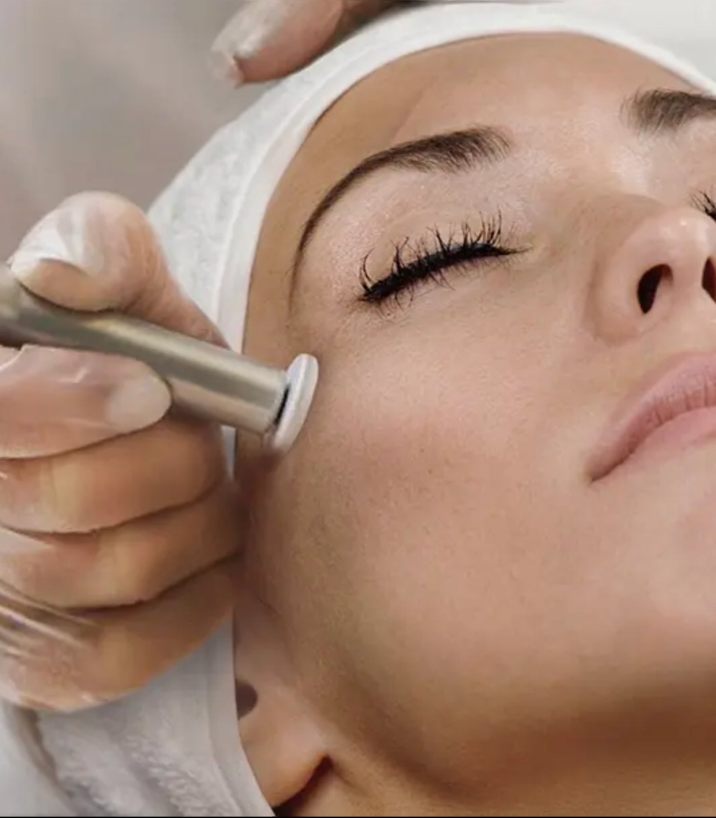 Procell microchanneling treatment in Grayshott Surrey for collagen stimulation and skin renewal